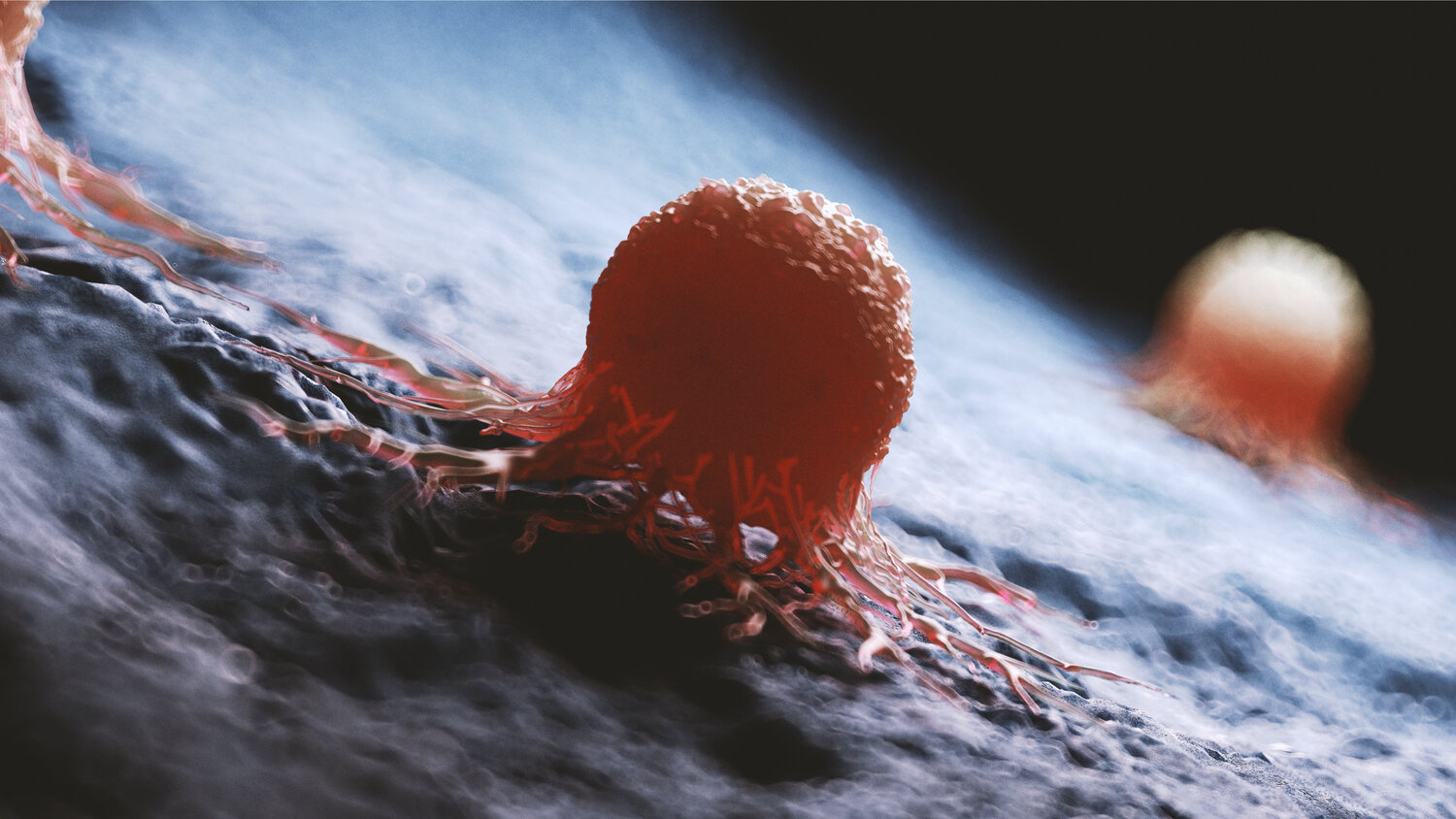 دانشمندان با نانوذرات اکسید آهن به جنگ سلول‌های سرطانی می‌روند